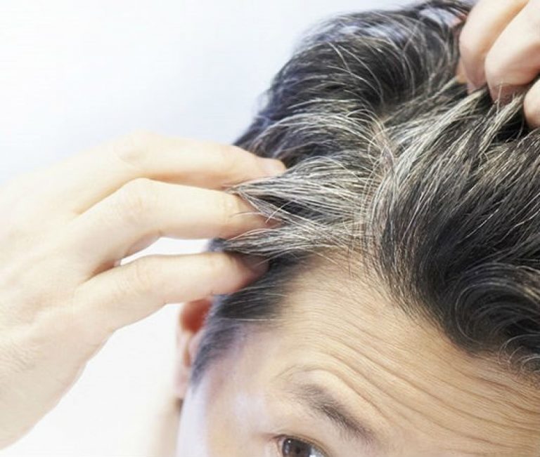 أهم الوصفات الطبيعية للقضاء على مشكلة الشعر الأبيض