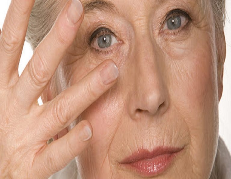 الوقاية من بقع الشيخوخة.. علاج بقع الشيخوخة كيف تتخلص من بقع الشيخوخة في أسرع وقت